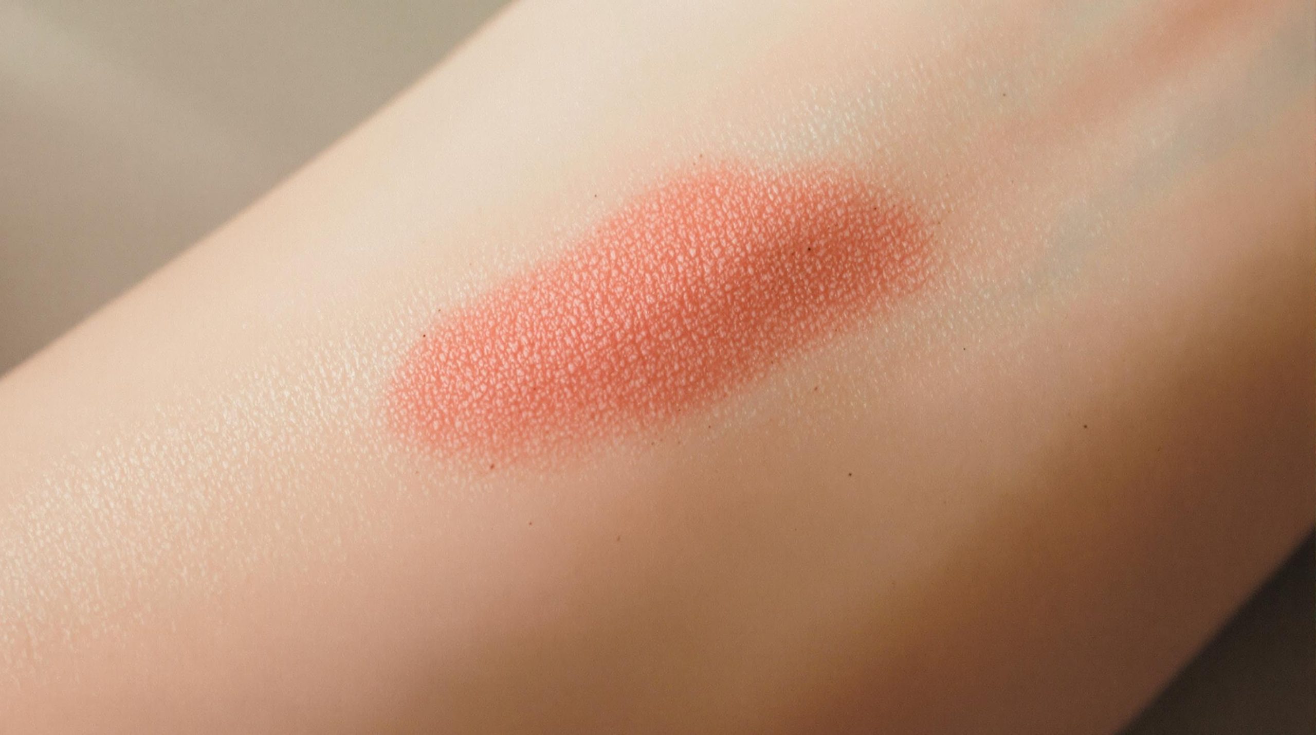 Vieille cicatrice qui rougit : causes et solutions - Instant Beaute Bien Être