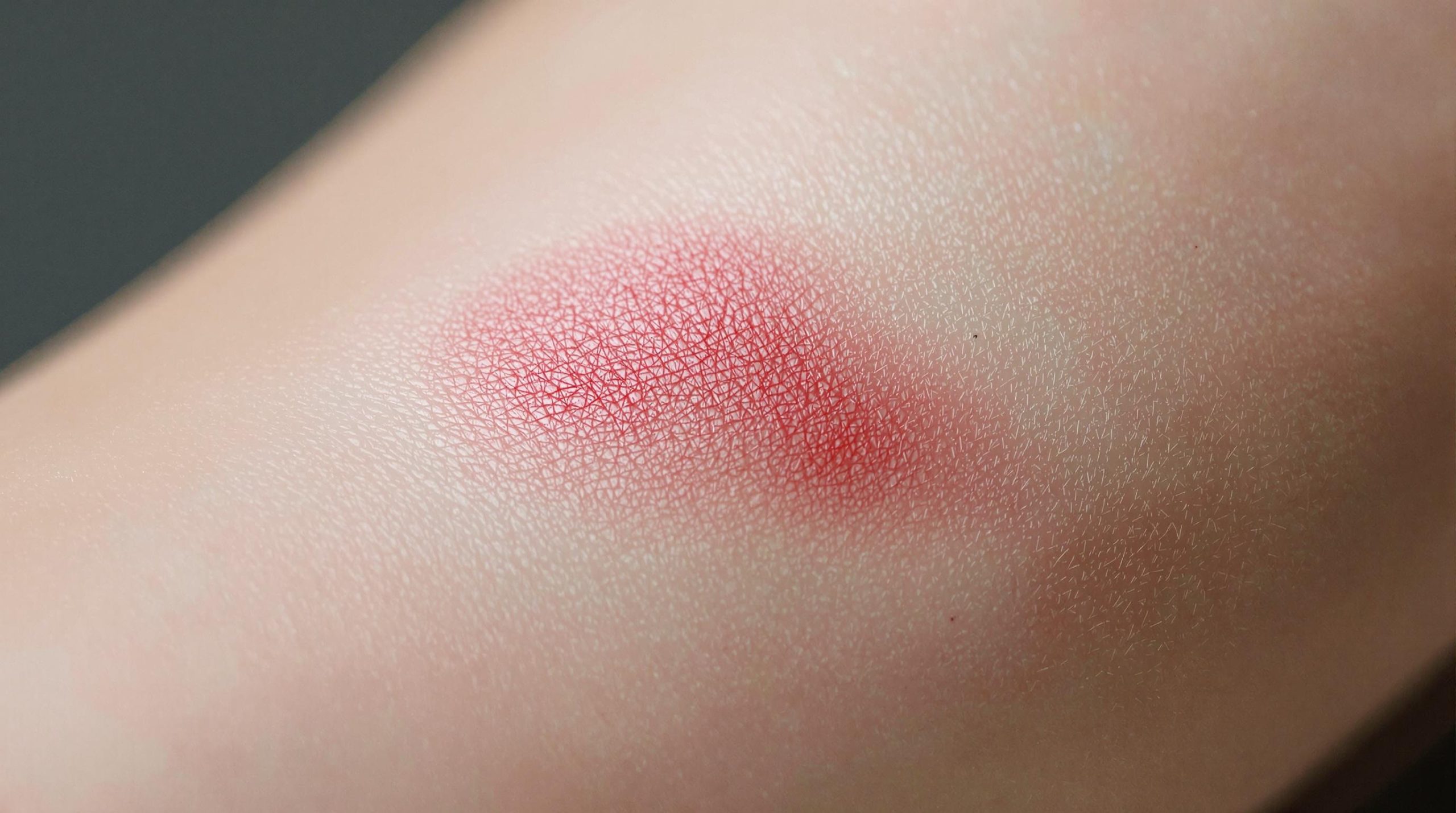 Combien de temps une cicatrice reste-t-elle rouge ? - Instant Beaute Bien Être