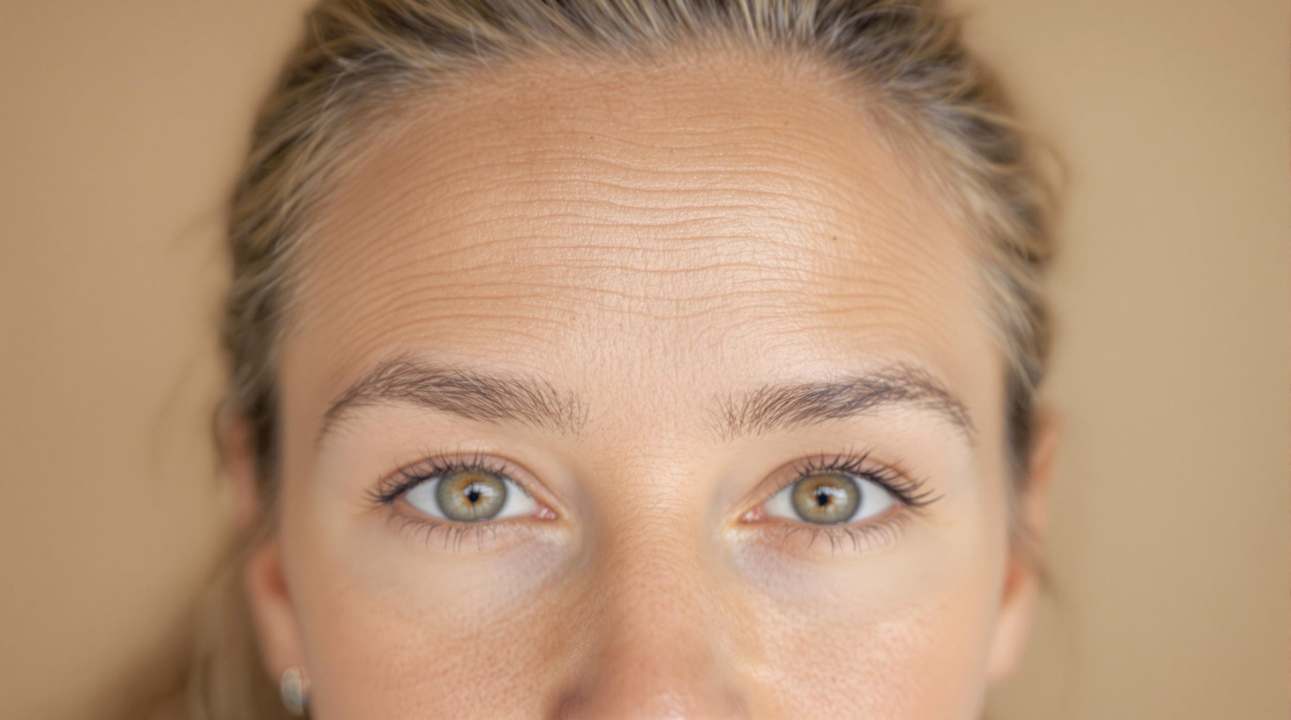Ridules sur le front : causes, traitements et prévention - Instant Beaute Bien Être