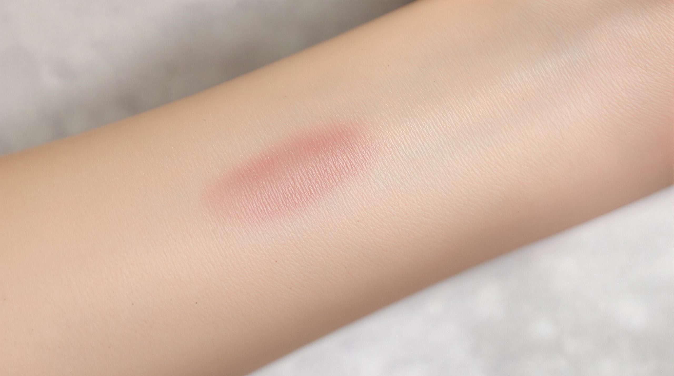 Cicatrice douloureuse : causes, traitements et prévention - Instant Beaute Bien Être